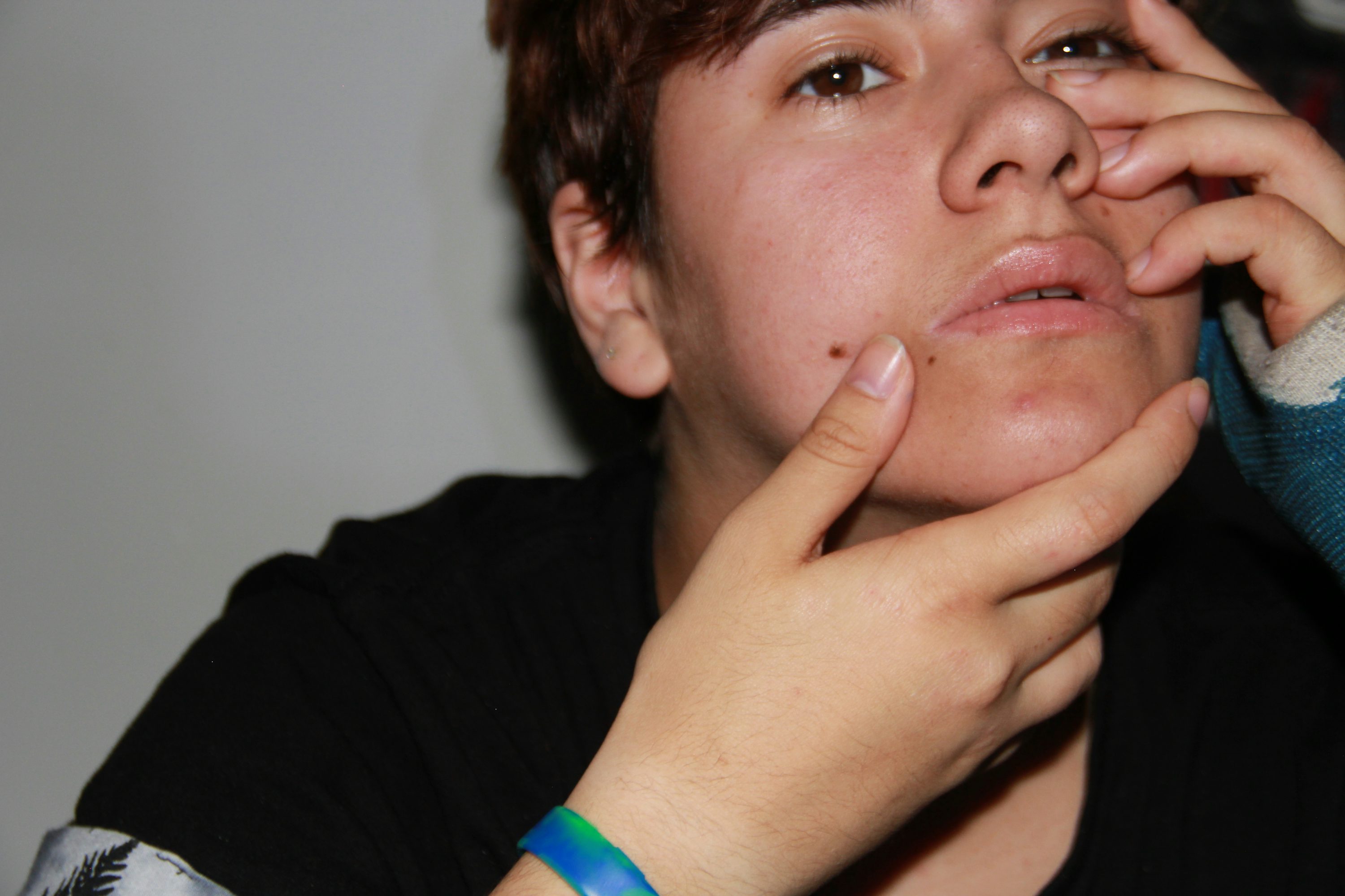 Cosmetic allergy insurance for beauty